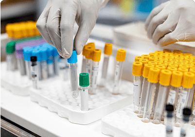 Lab technician handling test tubes in tray.